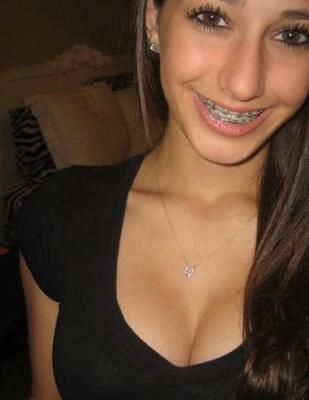 braces