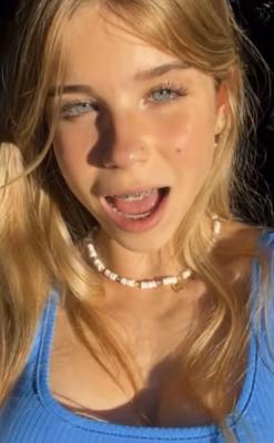 Teen blonde hot braces +