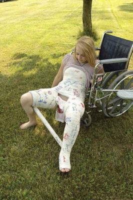 fuckable blond with two broken legs exposed